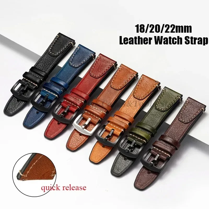 Universal Retro Watchband for  - Watches Rolex Smartwatch reseña y precio